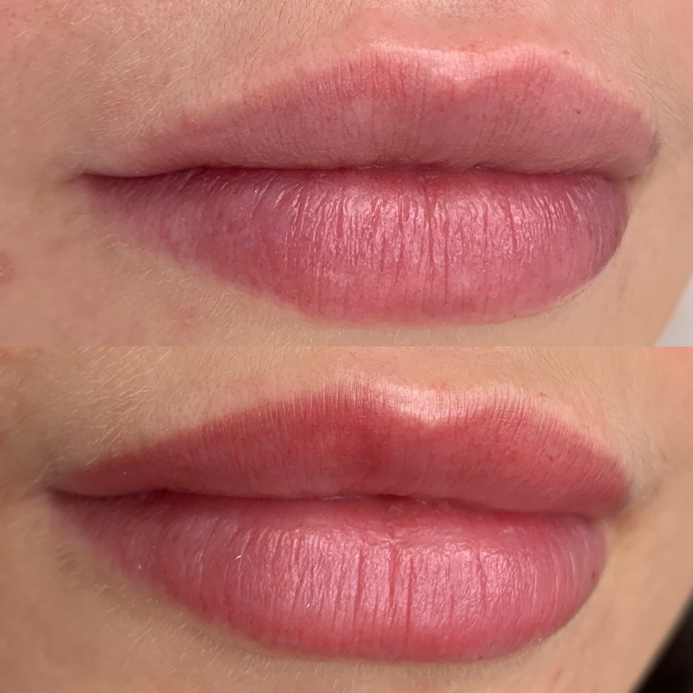 Lippenpigmentierung